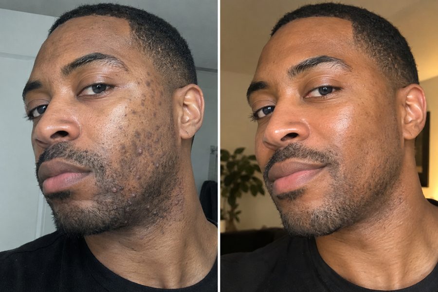 Chris C. before and after results