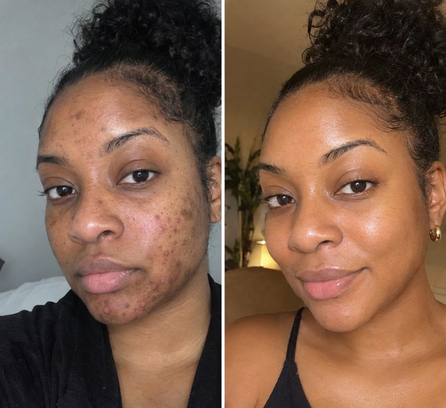 Jane D. before and after results