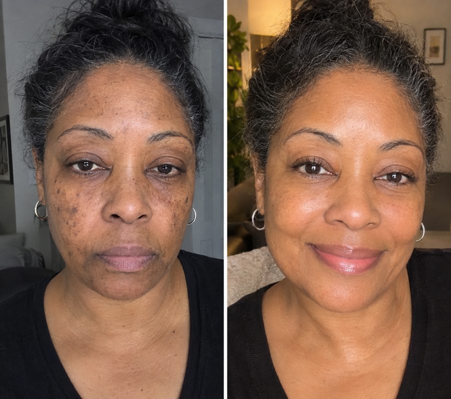 Nicole D. before and after results